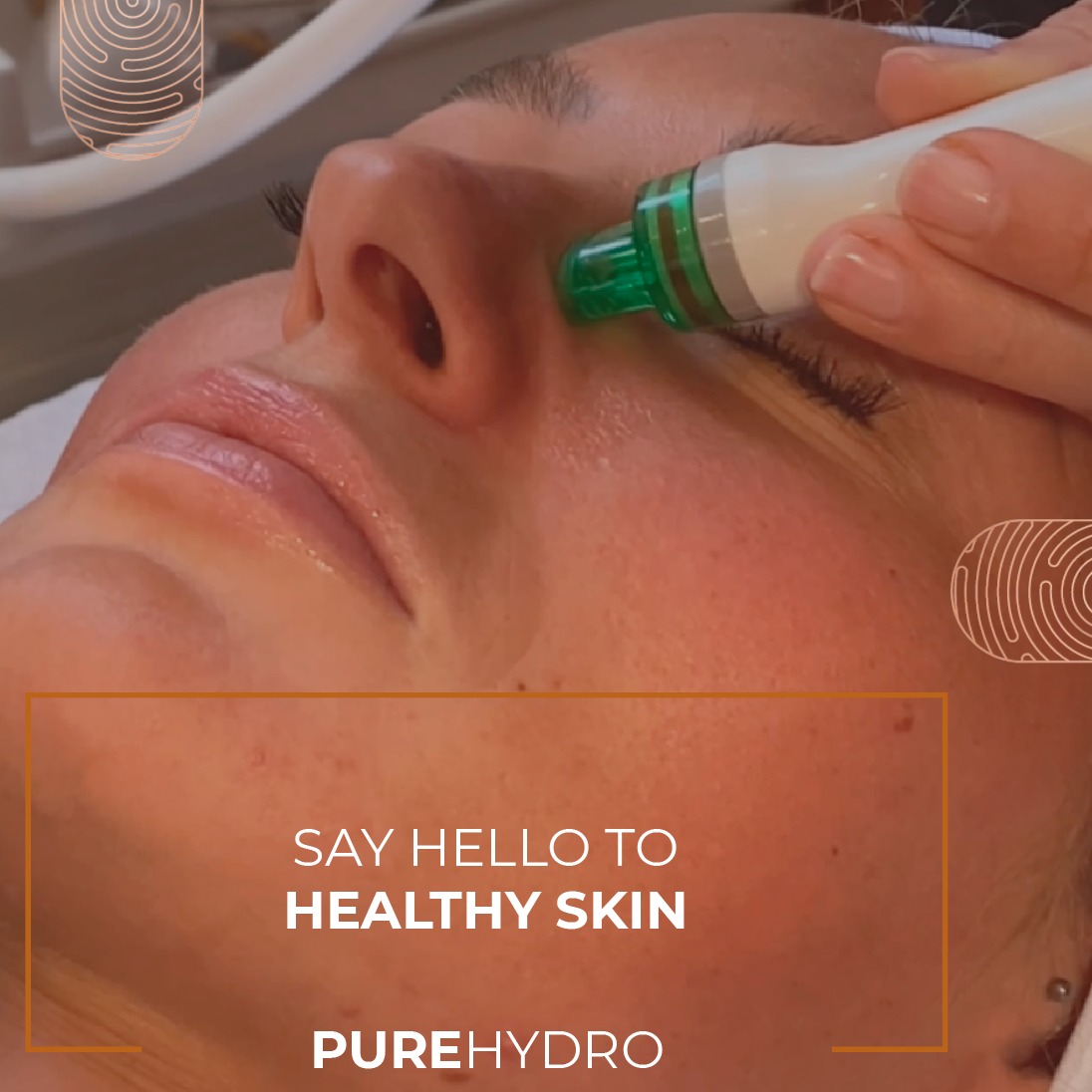 Spring Hydro Facials