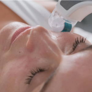 NEW Skinstorm at City Retreat Spas in Newcastle